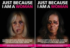 Μπριζίτ Μακρόν και Μισέλ Ομπάμα με μώλωπες σε καμπάνια κατά της βίας εναντίων των γυναικών