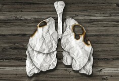 No smoking, το πρώτο βήμα για την πρόληψη του καρκίνου του πνεύμονα