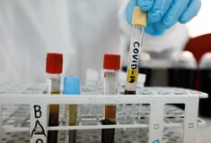 Ν.Κορέα: Καθησυχαστικοί οι ειδικοί για τους ιαθέντες που βρέθηκαν ξανά θετικοί - «Δεν πρόκειται για εκ νέου μολύνσεις»