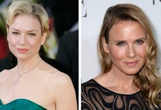 Πώς το πρόσωπο της Renee Zellweger δίχασε το ίντερνετ