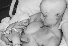 Οι συγκλονιστικές εικόνες της μητέρας που θηλάζει το γιο της για πρώτη φορά μετά τη μαστεκτομή