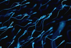 Το πρώτο φορητό τεστ για γρήγορη, φθηνή και αυτόματη ανάλυση του ανδρικού σπέρματος με τη βοήθεια του κινητού