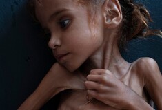 Η συγκλονιστική φωτογραφία της 7χρονης που αργοπεθαίνει από την πείνα διαγράφηκε από το Facebook