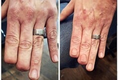 Το τατουάζ στα ακρωτηριασμένα δάχτυλα μιας γυναίκας που συγκίνησε χιλιάδες ανθρώπους
