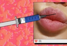 Πόσα πρησμένα χείλη με fillers αντέχουμε να δούμε ακόμα;