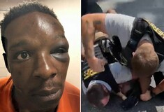 ΗΠΑ: Απολύθηκε αστυνομικός που ξυλοκόπησε μαύρο άνδρα μπροστά στα παιδιά του
