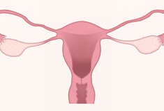 "Επαναστατικό" τεστ θα ανιχνεύει πολλούς γυναικολογικούς καρκίνους ταυτόχρονα