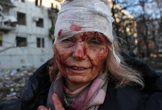 Ukrainian Teacher Speaks Out After Photos of Her Injuries Became a Haunting Symbol of the War