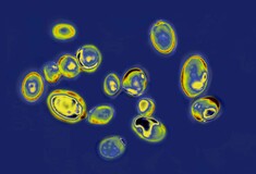 Candida auris: Η «νέα αναδυόμενη παγκόσμια απειλή» - Τι αναφέρει ο Νίκος Σύψας για τον μύκητα