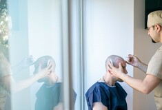 Τι να προσέξετε προτού προχωρήσετε στη μεταμόσχευση μαλλιών