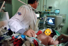Βραζιλία: Γεννήθηκε μωρό βάρους 7,3 κιλών - «Δεν περίμενα τέτοια έκπληξη» λέει η μητέρα