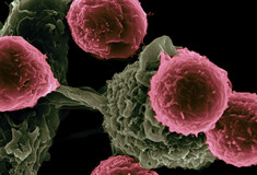 Εντοπίστηκε το «DNA του κακού του Μποντ» - Θα μπορούσε να αλλάξει τη θεραπεία κατά του καρκίνου
