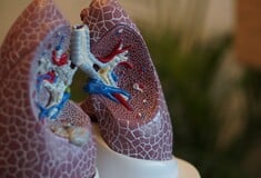 Τζανάκης για καρκίνο του πνεύμονα: Κάθε χρόνο χάνεται μια μικρή πόλη στην Ευρώπη