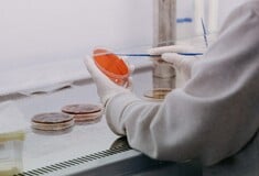Στρεπτόκοκκος Α: Πώς μεταδίδεται, τα συμπτώματα, τι να προσέξουν οι γονείς - Ο ΕΟΔΥ απαντά