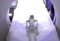 Έκαναν αξονική τομογραφία στους δύο «μη ανθρώπινους σκελετούς» του Μεξικό