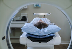 Ζει εδώ και 80 χρόνια με μια βελόνα στον εγκέφαλό της, χωρίς να το ξέρει