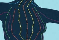 Μαθαίνουμε τα πάντα για τη μαστοδυνία, δηλαδή τον πόνο στον μαστό