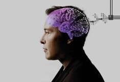 Ίλον Μασκ: Η Neuralink έκανε την πρώτη εμφύτευση μικροτσίπ σε ανθρώπινο εγκέφαλο