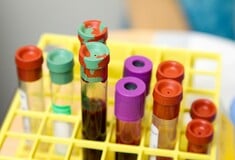 Το σύστημα αιμοδοσίας αλλάζει: Το αίμα θα συγκεντρώνεται σε Κέντρα Αίματος
