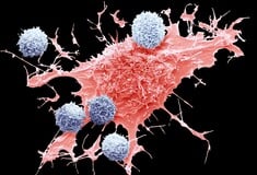 Τα σημάδια του καρκίνου θα μπορούσαν να εντοπιστούν χρόνια πριν από τα συμπτώματα, δείχνει νέα έρευνα