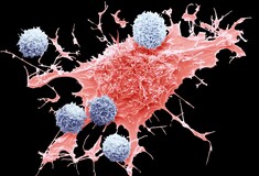 Νέες εξετάσεις αίματος θα εντοπίζουν πρόωρα τον καρκίνο