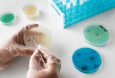 Μικροπλαστικά εντοπίστηκαν σε κάθε δείγμα από ανθρώπινους όρχεις σε επιστημονική μελέτη 
