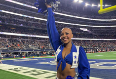 ΗΠΑ: Mαζορέτα των Dallas Cowboys με αλωπεκία χορεύει χωρίς περούκα για να ευαισθητοποιήσει το κοινό