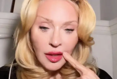 Αντιδράσεις για τα grills στα δόντια της Madonna - «Αυτό σίγουρα κοστίζει περισσότερο από το αυτοκίνητό μου»