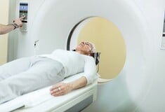 Επιληψία: Νέος μαγνητικός τομογράφος επιτρέπει χειρουργική επέμβαση και αλλάζει τη ζωή των ασθενών