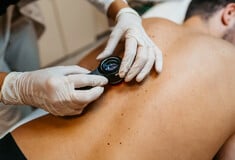 Νέο επαναστατικό εμβόλιο για τον καρκίνο του δέρματος χορηγείται σε ασθενείς στην Αγγλία μέσω ταχείας πρόσβασης από το NHS