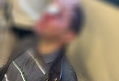 Ευθύνες στην ΕΛ.ΑΣ. αποδίδει το ΕΚΠΑ για την αιματηρή επίθεση κουκουλοφόρων στη Νομική 