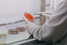 Θεσσαλονίκη: 15 θετικά κρούσματα στρεπτόκοκκου σε σχολεία κατά τη διάρκεια ελέγχων του ΕΟΔΥ