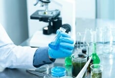 Βέλγιο: Πενήντα δύο παιδιά γεννήθηκαν από σπέρμα δότη με καρκινογόνο μετάλλαξη, σύμφωνα με τη "Soir" 
