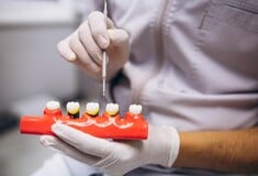 Επιστήμονες μετατρέπουν τα ούρα σε υλικό για οδοντικά και οστικά εμφυτεύματα