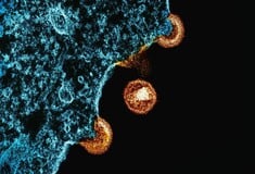 HIV: Ο FDA ενέκρινε τη μοναδική ένεση στον κόσμο για πρόληψη του ιού