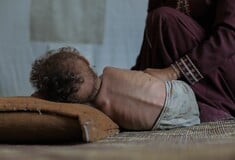 Γάζα: «Δεν υπάρχουν ενδείξεις γενικευμένου υποσιτισμού» επιμένει το Ισραήλ