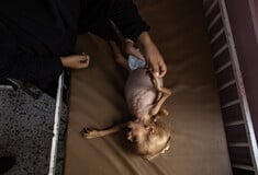 Τραγικές μαρτυρίες από τη Γάζα: Υποσιτισμένα παιδιά φτάνουν καθημερινά στο νοσοκομείο 