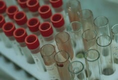 Ηνωμένο Βασίλειο: Ασθενείς θα υποβληθούν δοκιμαστικά σε εξέταση αίματος που θα μπορούσε να «αλλάξει ριζικά» τη διάγνωση του Αλτσχάιμερ