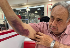 ΗΠΑ: 79χρονος πολίτης καταγγέλλει πράκτορες της ICE για βίαιη επίθεση – Ζητά 50 εκατ. δολάρια