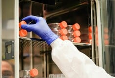 Έρευνα του Cambridge: Θετικά τα αποτελέσματα νέας κλινικής δοκιμής για τη σκλήρυνση κατά πλάκας
