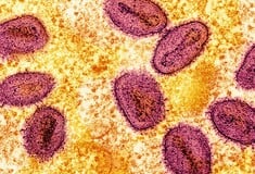 Το πιο επιθετικό στέλεχος της mpox εντοπίστηκε σε κάτοικο της Καλιφόρνια – Χωρίς επαφή με το εξωτερικό
