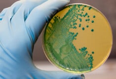 Τι συμβαίνει στις ΗΠΑ με την επιδημία λιστέριας – Ανακαλούνται έτοιμα γεύματα ζυμαρικών