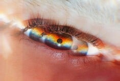 Γεγονός η πρώτη επιτυχημένη αλλαγή χρώματος ματιών στην Ελλάδα