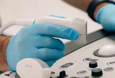 ΓΙΑ Σ/Κ: Πώς ένας απλός υπέρηχος λαιμού μπορεί να εντοπίσει τον κίνδυνο καρδιακής προσβολής και εγκεφαλικού