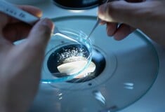 Καρκίνος: Σπάνιος τύπος παρουσιάζει απότομη αύξηση στις νεότερες ηλικίες