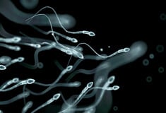 Σπέρμα από δότη με καρκινικό γονίδιο χρησιμοποιήθηκε για τη σύλληψη σχεδόν 200 παιδιών