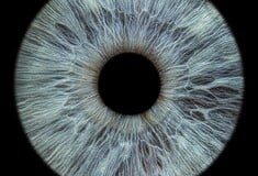 ΚΕΡΑΤΟΕΙΔΗΣ 3D ΕΚΤΥΠΩΣΗ ΟΡΑΣΗ