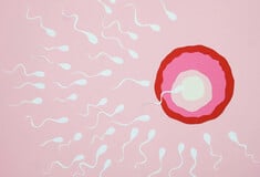 ΣΠΕΡΜΑ ΔΟΤΗ ΚΑΡΚΙΝΙΚΟ ΓΟΝΙΔΙΩΜΑ