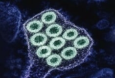 Η «υπεργρίπη» σαρώνει την Ευρώπη - Αυξάνεται η πίεση στα συστήματα υγείας προειδοποιεί ο ΠΟΥ