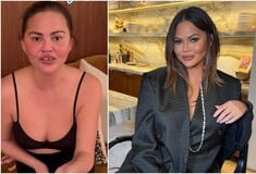 «Μου έπεσε το δόντι» - Το ατύχημα της Κρίσι Τέιγκεν ενώ έπαιζε με τα παιδιά της